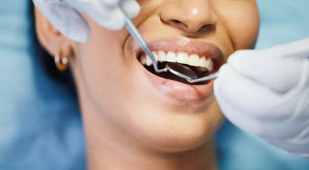 Best Pediatric Emergency Dentist in Kalama, WA